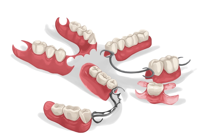 2026 guide: Why Same-Day Dentures Service in Charleston is the Smartest Choice for Affordable Dentures