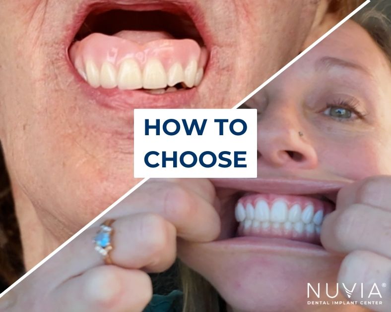 Affordable Dentures in North Charleston: Same-Day Options and Care Essentials