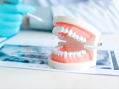 Same-Day Dentures Service