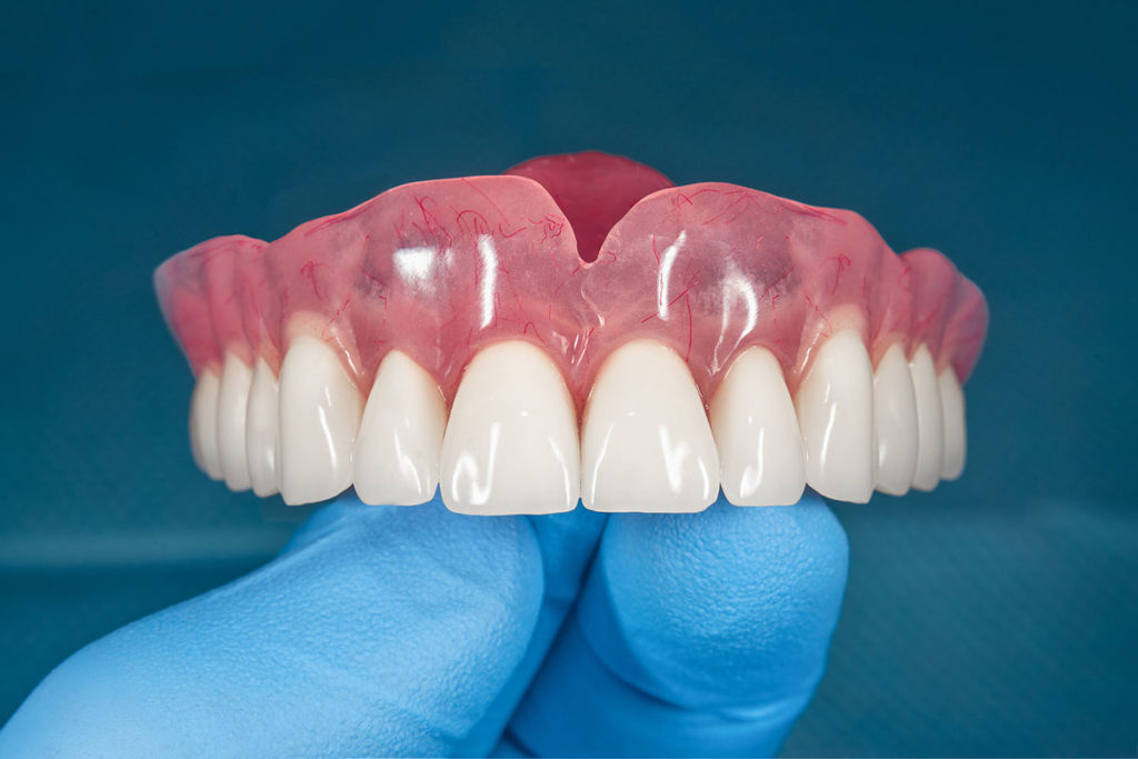 How to Get Affordable Dentures in North Charleston