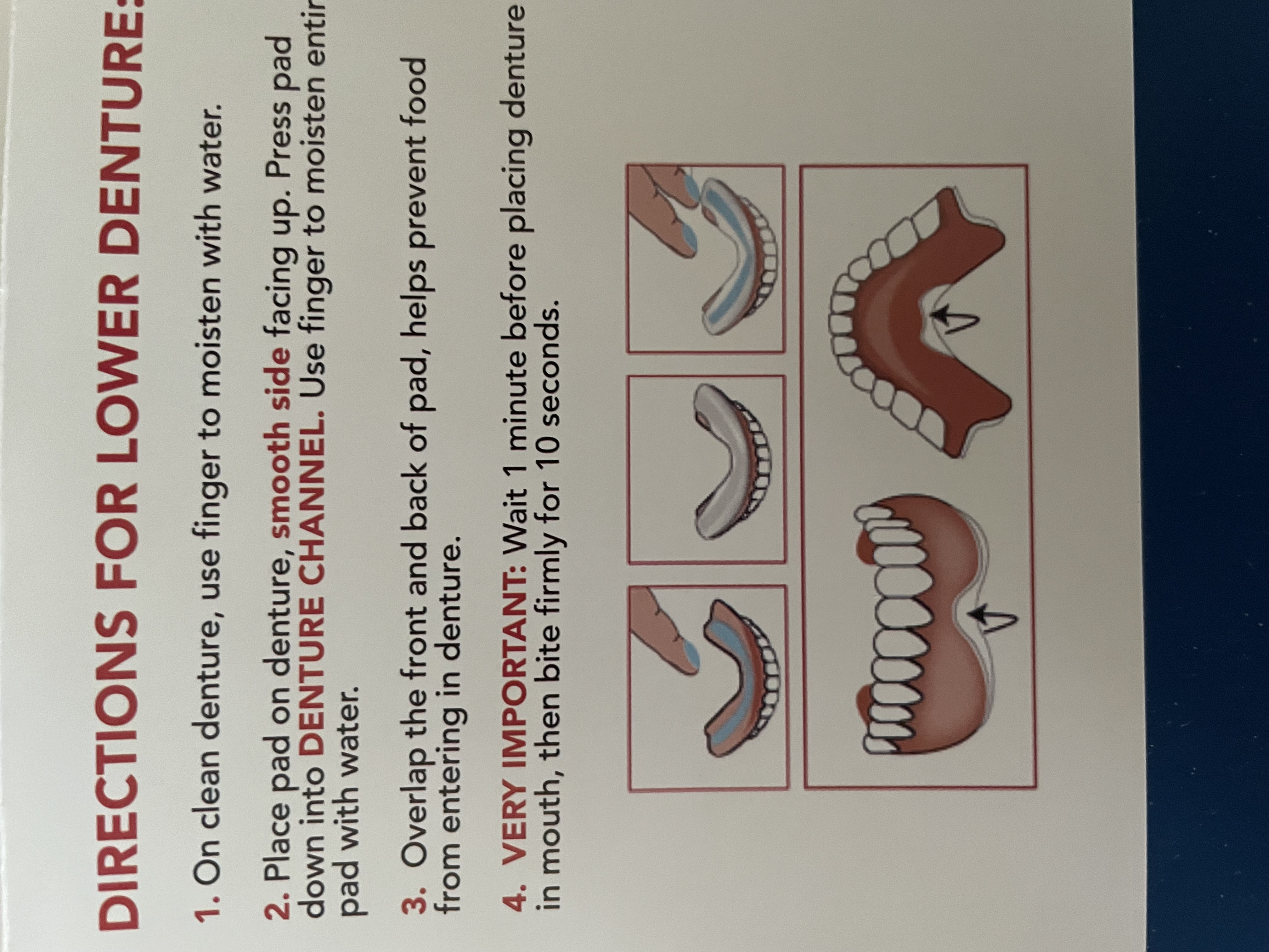 Understanding the Key Differences Between Denture Glue and Denture Adhesive