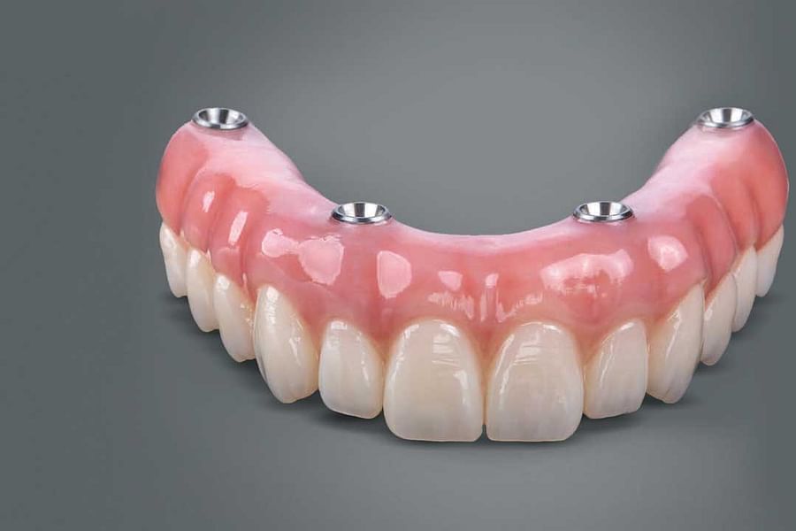 cost of denture adhesives