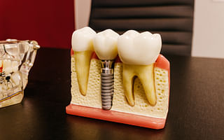 🧠 Understanding Denture Implants: Take the Quiz Now! 📝